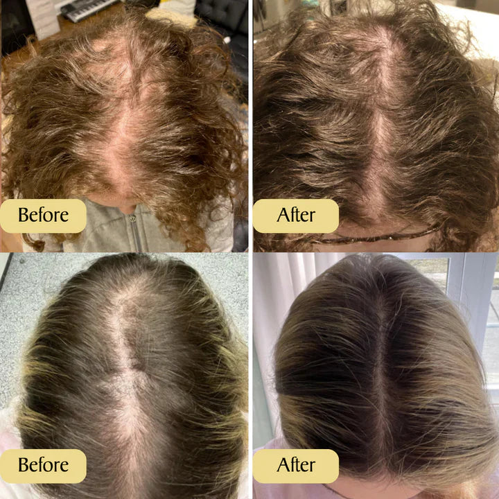 Organic Natural Hair Growth Oil | ⚡Buy 1 Get 1 Free⚡