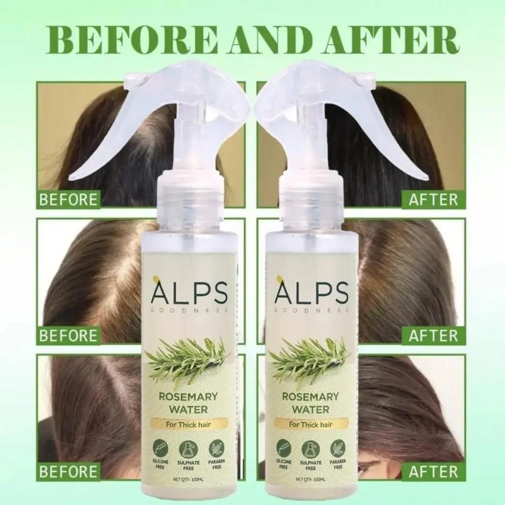 Rosemary Water Spray | For Hair Regrowth (Pack of 3 😍)