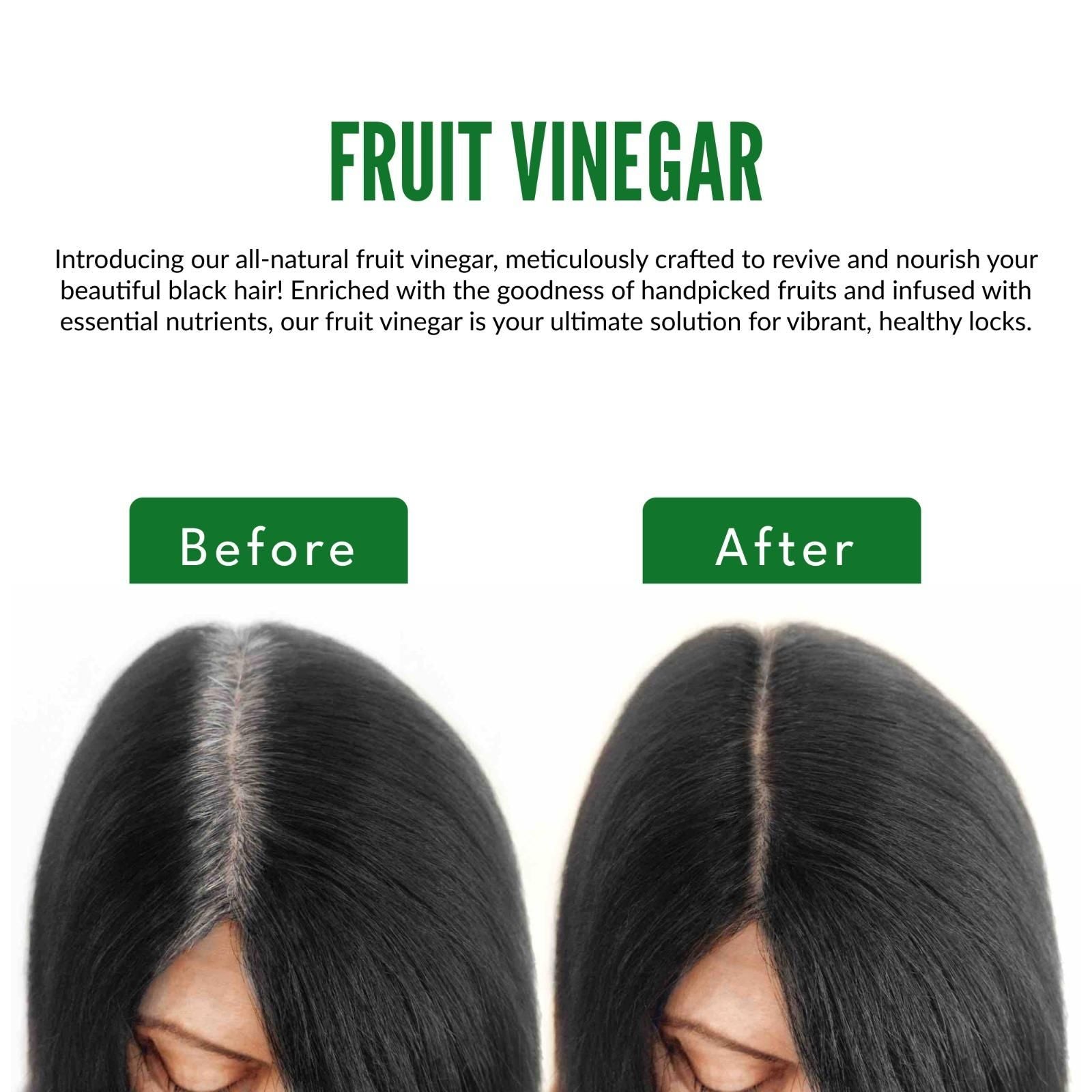 SISO FRUIT VINEGAR Shampoo (Pack of 2) 240ml