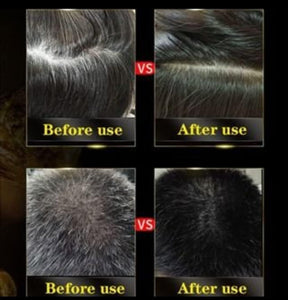 3-IN-1 AYURVEDIC BLACK HAIR DYE SHAMPOO - (Buy 1 Get 1 Free)