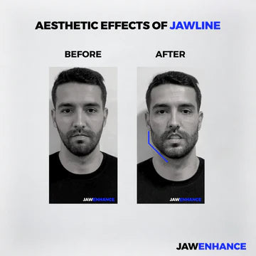 Jaw Enhance™ - Ultimate Facial Exerciser (Pack Of 2)