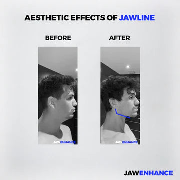 Jaw Enhance™ - Ultimate Facial Exerciser (Pack Of 2)